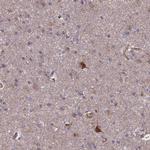 SPOCK2 Antibody in Immunohistochemistry (IHC)