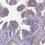 SPOCK2 Antibody in Immunohistochemistry (IHC)