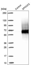 SPOCK2 Antibody in Western Blot (WB)