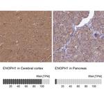 ENOPH1 Antibody in Immunohistochemistry (IHC)