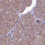 ENOPH1 Antibody in Immunohistochemistry (IHC)