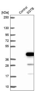 SGTB Antibody in Western Blot (WB)