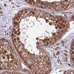 SPDL1 Antibody in Immunohistochemistry (IHC)