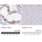 CT45A Antibody in Immunohistochemistry (IHC)