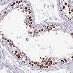 CT45A Antibody in Immunohistochemistry (IHC)