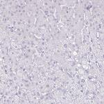 CT45A Antibody in Immunohistochemistry (IHC)