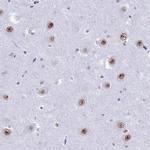 U2AF1 Antibody in Immunohistochemistry (IHC)