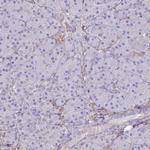 ABCA8 Antibody in Immunohistochemistry (IHC)