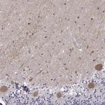 EIF4E1B Antibody in Immunohistochemistry (IHC)