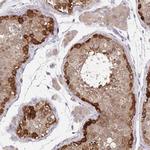 BAG6 Antibody in Immunohistochemistry (IHC)