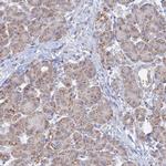 BRP44L Antibody in Immunohistochemistry (IHC)