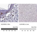 ALDH3B2 Antibody