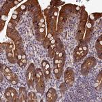 ABCB8 Antibody in Immunohistochemistry (IHC)