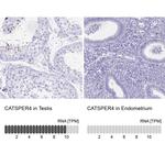 CATSPER4 Antibody in Immunohistochemistry (IHC)