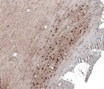 SCRT1 Antibody in Immunohistochemistry (IHC)