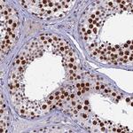 TAF9B Antibody in Immunohistochemistry (IHC)