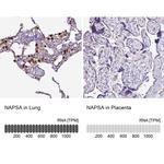 NAPSA Antibody in Immunohistochemistry (IHC)