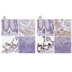 NAPSA Antibody in Immunohistochemistry (IHC)