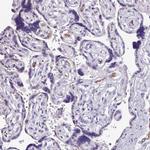 NAPSA Antibody in Immunohistochemistry (IHC)