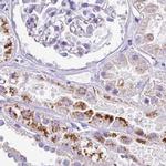 NAPSA Antibody in Immunohistochemistry (IHC)