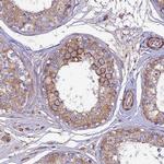 ARMER Antibody in Immunohistochemistry (IHC)