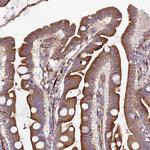 ARMER Antibody in Immunohistochemistry (IHC)