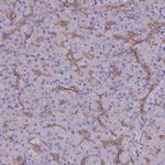 ARMER Antibody in Immunohistochemistry (IHC)