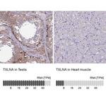 TXLNA Antibody