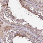 PGK1 Antibody in Immunohistochemistry (IHC)