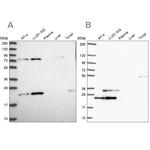 eIF3k Antibody in Western Blot (WB)