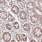 LARS2 Antibody in Immunohistochemistry (IHC)