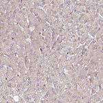 GPD2 Antibody in Immunohistochemistry (IHC)