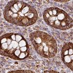 GPD2 Antibody in Immunohistochemistry (IHC)