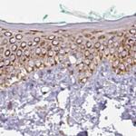 GPD2 Antibody in Immunohistochemistry (IHC)