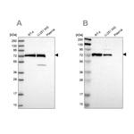 GPD2 Antibody in Western Blot (WB)