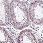 TCEAL5 Antibody in Immunohistochemistry (IHC)