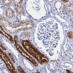 GGT1 Antibody in Immunohistochemistry (IHC)