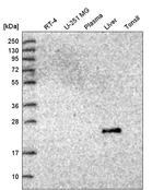 GGT1 Antibody in Western Blot (WB)