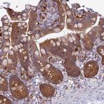 UBE2G1 Antibody in Immunohistochemistry (IHC)