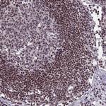 DC8 Antibody in Immunohistochemistry (IHC)