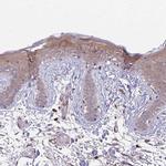 Desmoplakin Antibody in Immunohistochemistry (IHC)