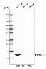 S100A16 Antibody