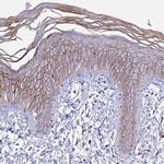 S100A16 Antibody in Immunohistochemistry (IHC)