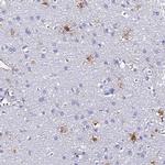 S100A16 Antibody in Immunohistochemistry (IHC)