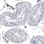 KRT77 Antibody in Immunohistochemistry (IHC)