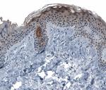 KRT77 Antibody in Immunohistochemistry (IHC)