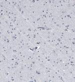 KRT77 Antibody in Immunohistochemistry (IHC)