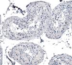 KRT77 Antibody in Immunohistochemistry (IHC)