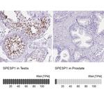 SPESP1 Antibody in Immunohistochemistry (IHC)