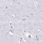 SPESP1 Antibody in Immunohistochemistry (IHC)